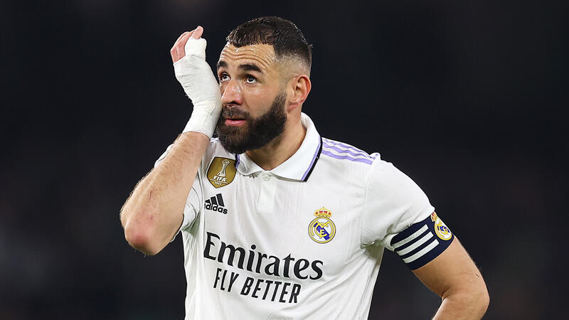 Lyon träumt von Rückkehr des verlorenen Sohns Benzema